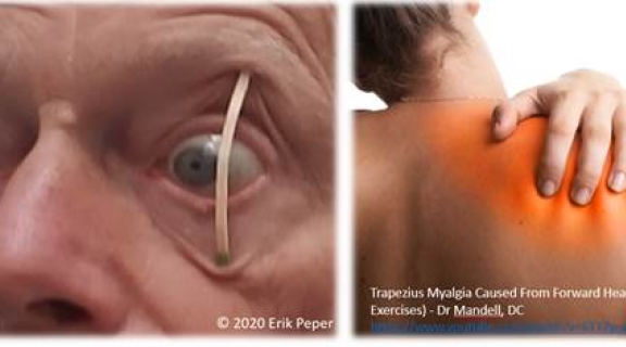 person with eyes propped open and massaging painful shoulder